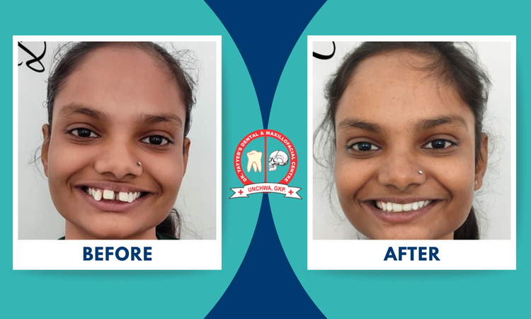 braces treatment at dr tayyeb's